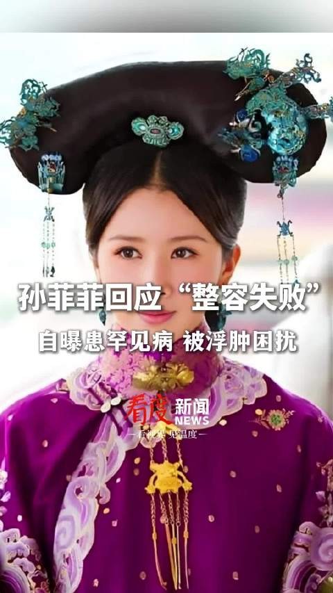 孙菲菲自曝患库欣氏综合症