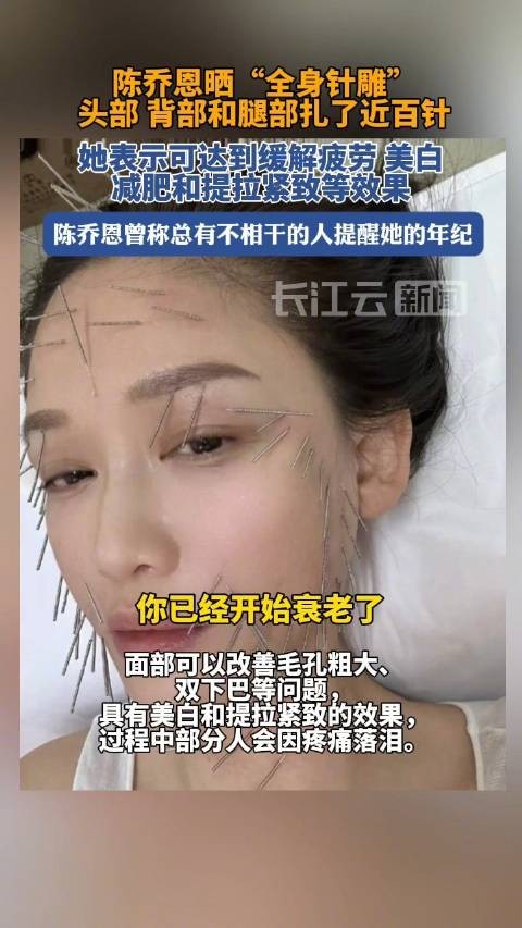 陈乔恩回应全身针雕保养法 :你问我疼吗?你说呢?