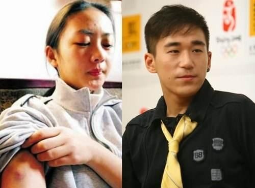 娱乐圈惨遭家暴的7位女星，手指被打断！鼻梁被打折！