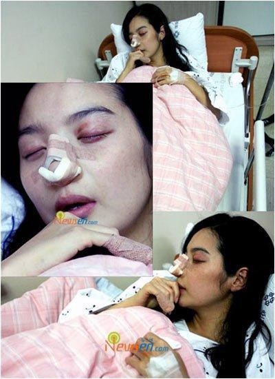 娱乐圈惨遭家暴的7位女星，手指被打断！鼻梁被打折！