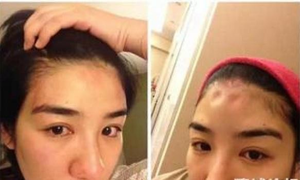 娱乐圈惨遭家暴的7位女星，手指被打断！鼻梁被打折！