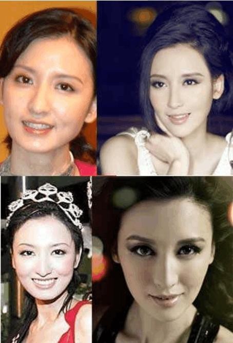 一看就是整容脸, 却死活不承认自己整容的明星