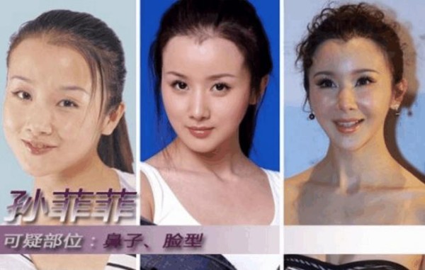 一看就是整容脸, 却死活不承认自己整容的明星