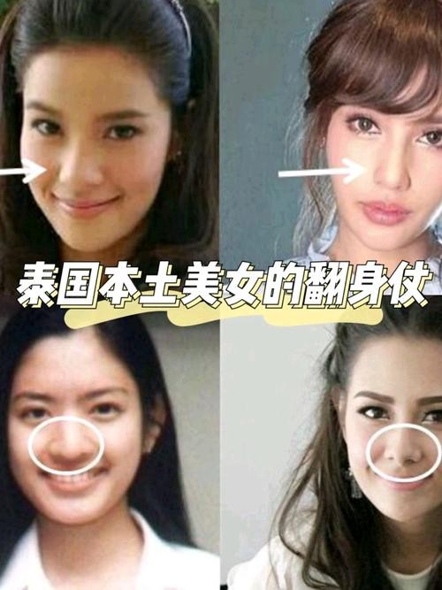 明星整容前后照片对比，男演员整容前后变化最大的(优选推荐)