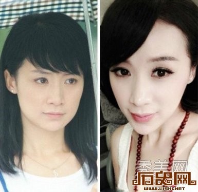 [多图]盘点娱乐圈疯狂整容换脸的十大女星