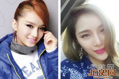 [多图]盘点娱乐圈疯狂整容换脸的十大女星