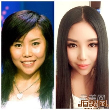 [多图]盘点娱乐圈疯狂整容换脸的十大女星