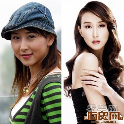 [多图]盘点娱乐圈疯狂整容换脸的十大女星