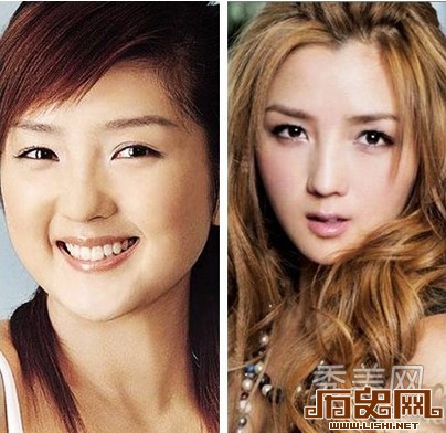 [多图]盘点娱乐圈疯狂整容换脸的十大女星