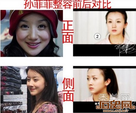 [多图]盘点娱乐圈疯狂整容换脸的十大女星