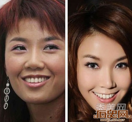 [多图]盘点娱乐圈疯狂整容换脸的十大女星
