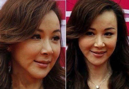 女星整容前后大对比，图2整容无人诋毁