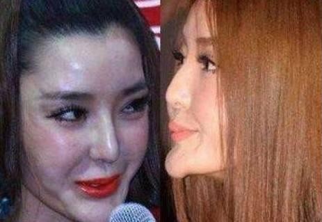 女星整容前后大对比，图2整容无人诋毁