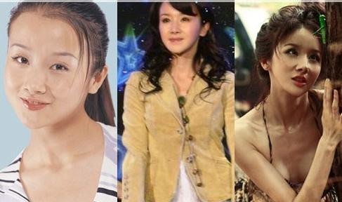 女明星整容前后照片大对比，你们觉得哪个变化最大呢？