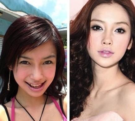 女明星整容前后照片大对比，你们觉得哪个变化最大呢？