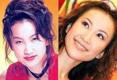 女明星整容前后照片大对比，你们觉得哪个变化最大呢？