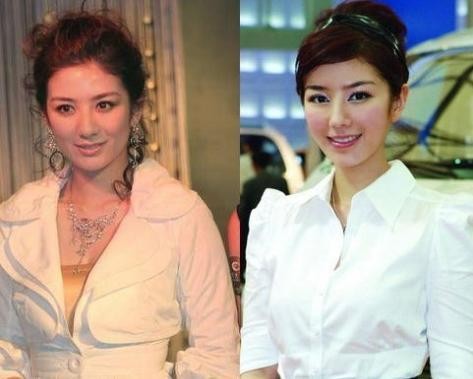 女明星整容前后照片大对比，你们觉得哪个变化最大呢？