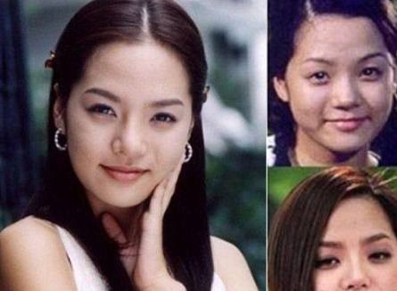 韩国女星整容前后对比照，李多海变化最大！