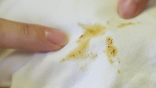 油渍滴在衣服上洗不掉？只要准备好这几样东西，再顽固也能清除