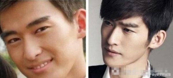 娱乐圈明星整容前后大对比, 最后一位换了个头