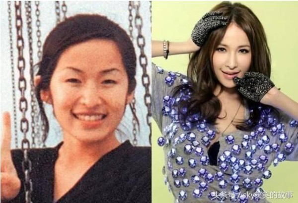 娱乐圈明星整容前后大对比, 最后一位换了个头