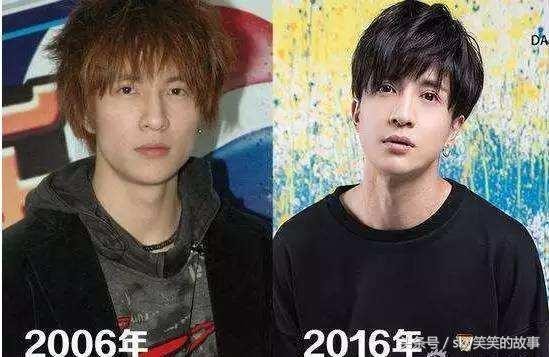 娱乐圈明星整容前后大对比, 最后一位换了个头