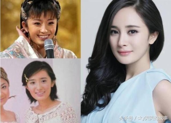 娱乐圈明星整容前后大对比, 最后一位换了个头