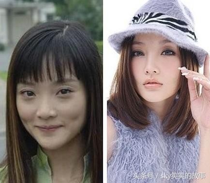娱乐圈明星整容前后大对比, 最后一位换了个头