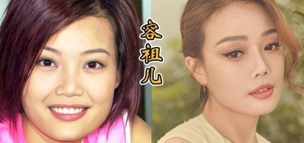明星整容前后对比（明星整容前后照片对比惊人）