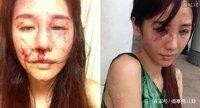 女明星家暴男友，被送到警察局！这么漂亮，看不出来啊！