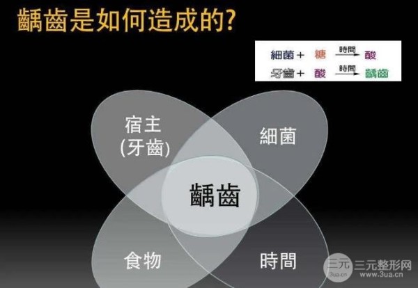 根管治疗