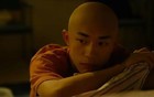 切掉右脸后，弟弟又活了841天 | 人间