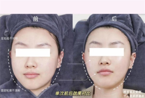 花印V脸<a target=