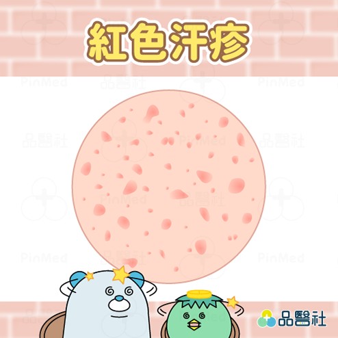 汗疹原因_紅色汗疹
