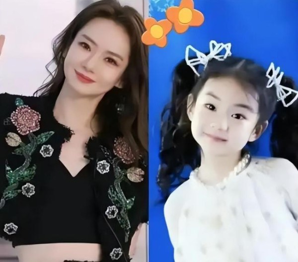 戚薇提醒医美要谨慎 坦诚分享引共鸣