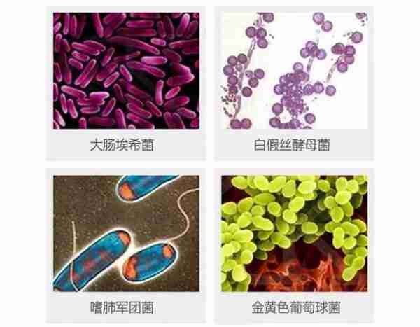 地下室洗菜染真菌，环境与健康的警示