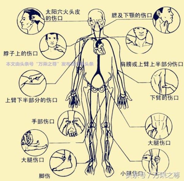 军队战场急救教程，学一学肯定没坏处