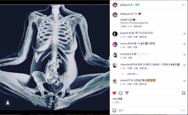 玉兔晒出孕妇照体内全透视。(图/玉兔IG)