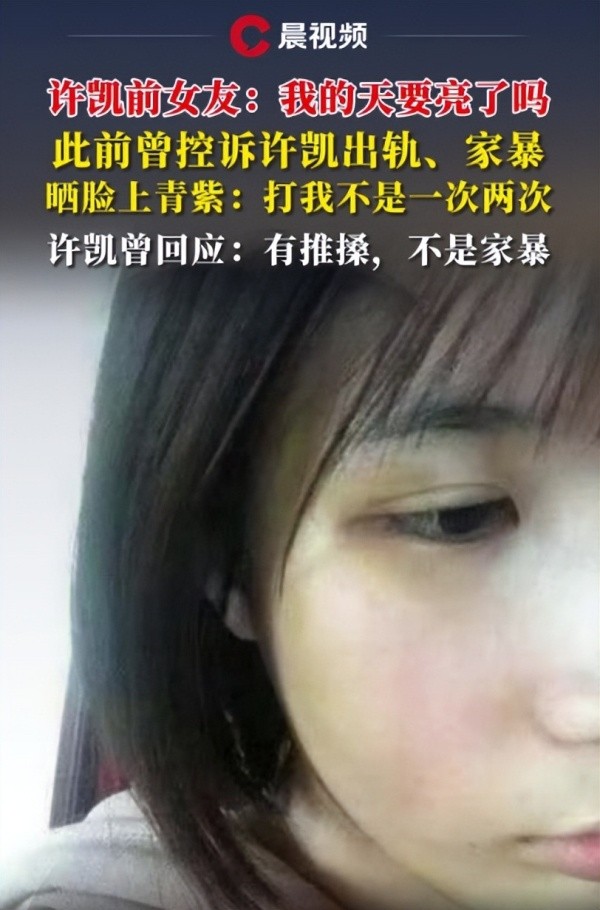 标题：许凯前女友疑似遭家暴，回应称不是第一次两次