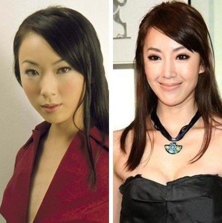 温碧霞容祖儿明星整容前后对比照