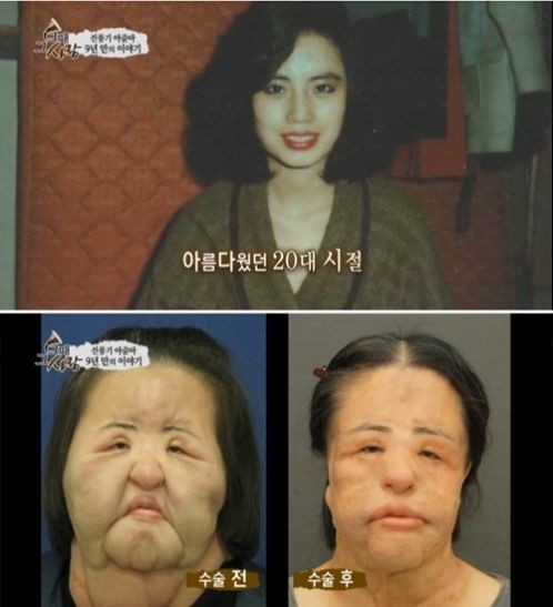 电风扇大妈不忍直视 女明星整容前后大对比