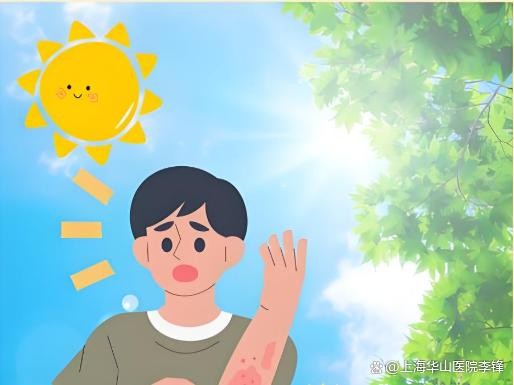夏季巧防晒，远离皮肤病：这篇科学防护指南及防晒误区请收好！