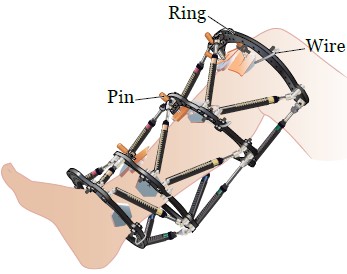 Figure 3. Leg pin and wires wrapped in gauze