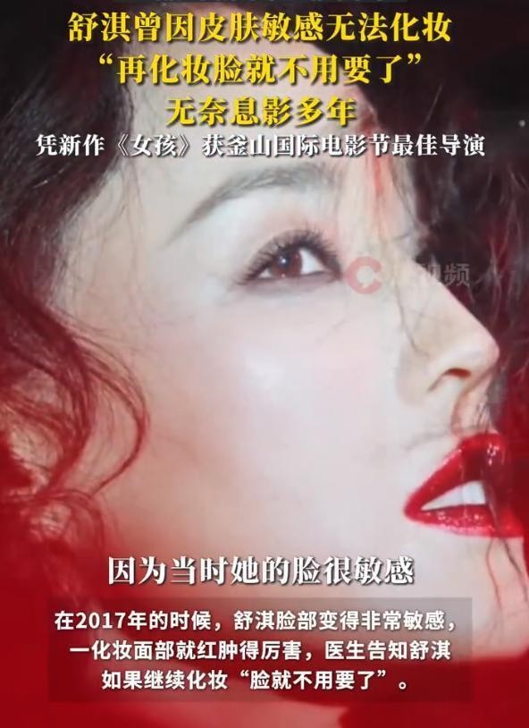 王晶曝光舒淇息影真相：2017年化妆就红肿，医生放话 “脸不用要了”