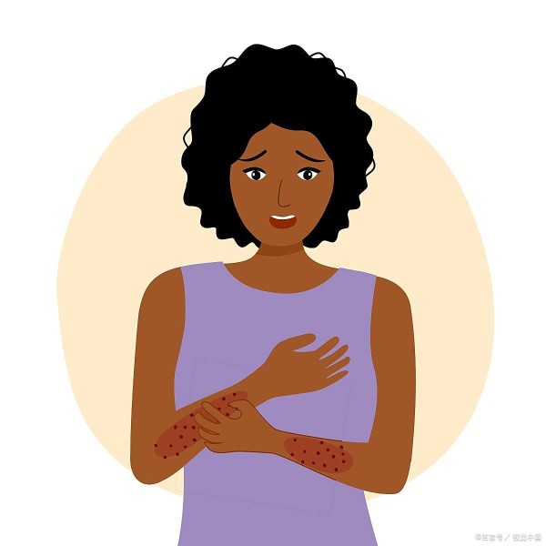 季节变换引发皮肤病？换季护肤与预防指南