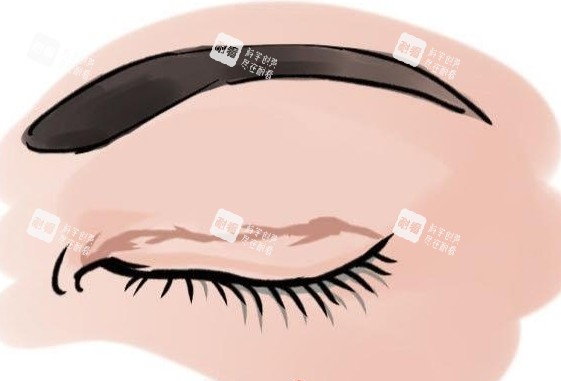 眼角增生疤痕动画展示图