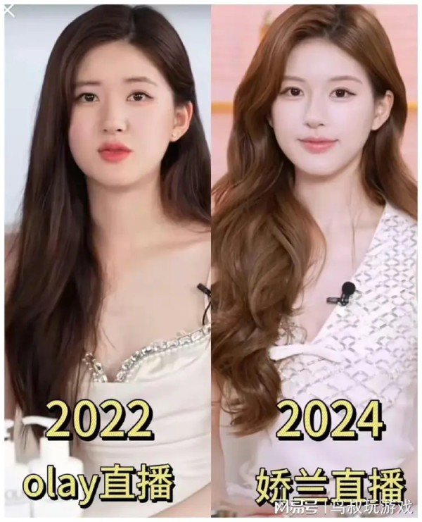 赵露思整容争议：真相与错觉的较量