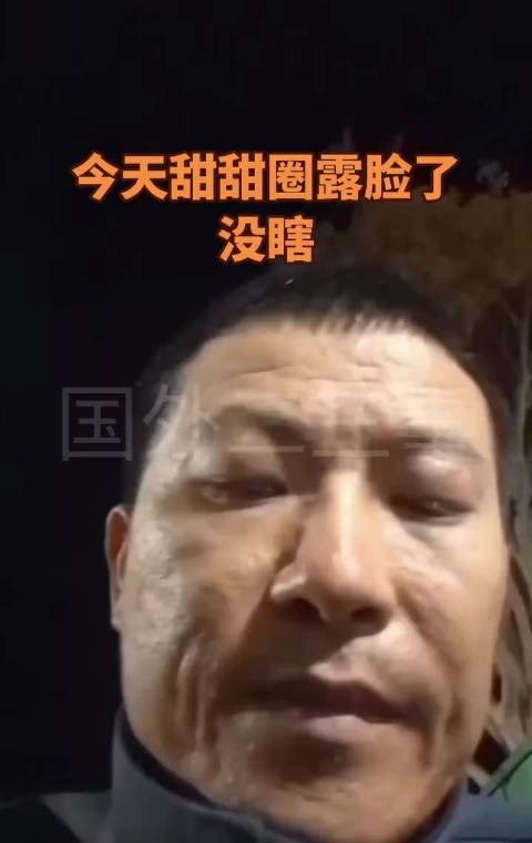 88年甜甜圈现满脸坑洼引热议