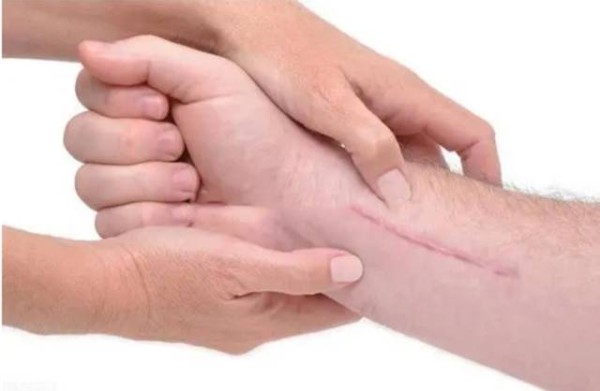 怎么样快速祛痘印的方法日常护肤[tag]