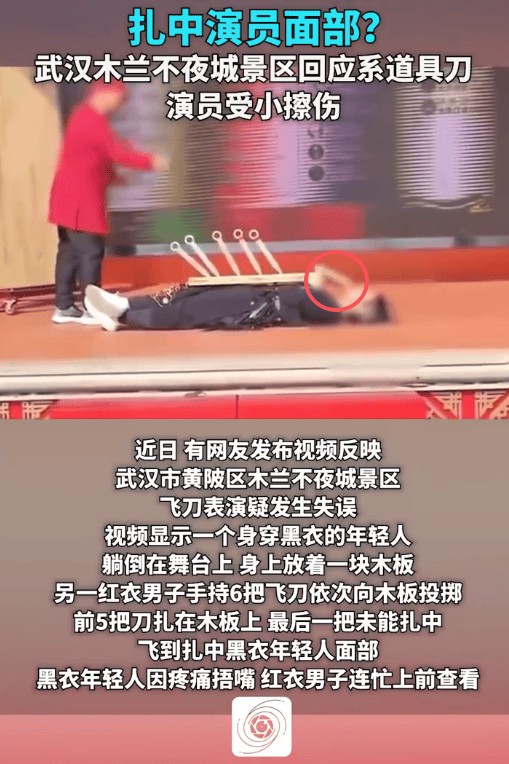 景区回应飞刀表演失误扎中演员面部：仅有一点擦伤，无大碍